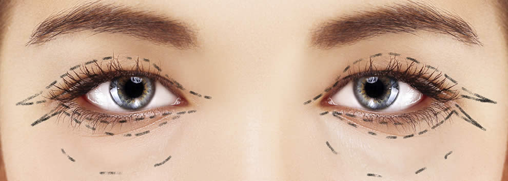Cosmetic and Reconstructive Eyelid Surgery